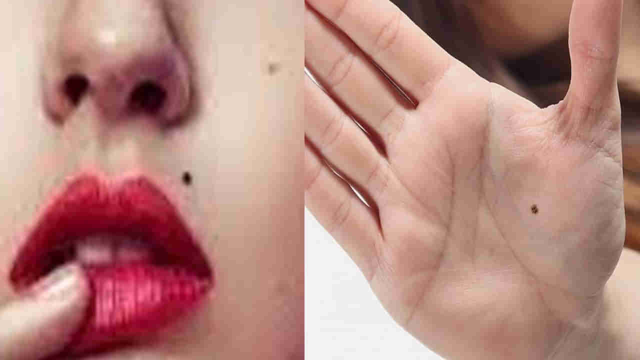 Lucky Moles on Your Body: అదృష్టాన్ని తెలియజేసే పుట్టుమచ్చలు శరీరంపై ఏ భాగాలపై ఉంటాయంటే..