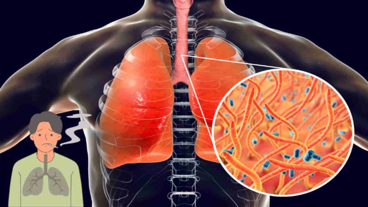 Healthy Lungs: ఊపిరితిత్తులలో కఫం, శ్లేష్మం వెంటనే క్లీన్ అవ్వాలా.. ఈ ఇంటి చిట్కాలు పనిచేస్తాయి!