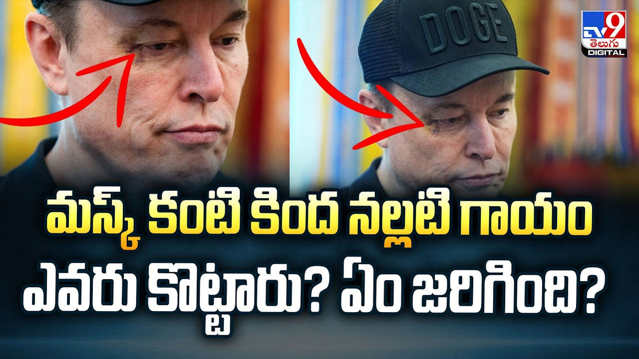 మస్క్ కంటి కింద నల్లటి గాయం ఎవరు కొట్టారు? ఏం జరిగింది? వీడియో