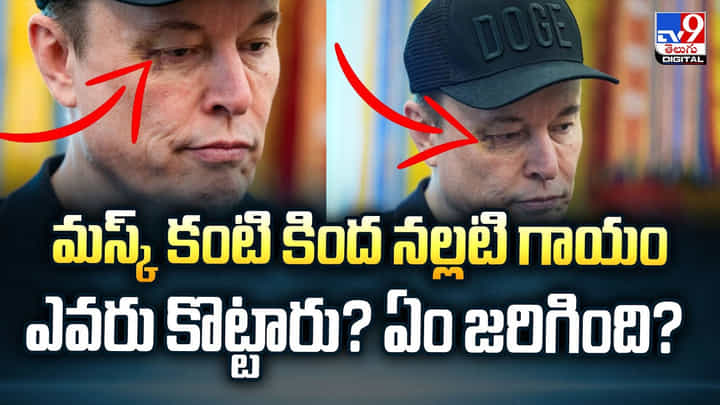 మస్క్ కంటి కింద నల్లటి గాయం ఎవరు కొట్టారు? ఏం జరిగింది? వీడియో మస్క్ కంటి కింద నల్లటి గాయం ఎవరు కొట్టారు? ఏం జరిగింది? వీడియో