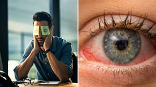 Beauty Tips: గుడ్డు పెంకులతో ఫేస్‌ ప్యాక్‌ ఎప్పుడైనా ట్రై చేశారా? వారానికి 2 సార్లు అప్లై చేశారంటే..