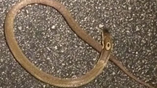 Viral: కడుపులో అసౌకర్యంగా ఉందని ఆస్పత్రికి యువకుడు – స్కానింగ్ తీసి రిపోర్ట్ చూడగా స్టన్