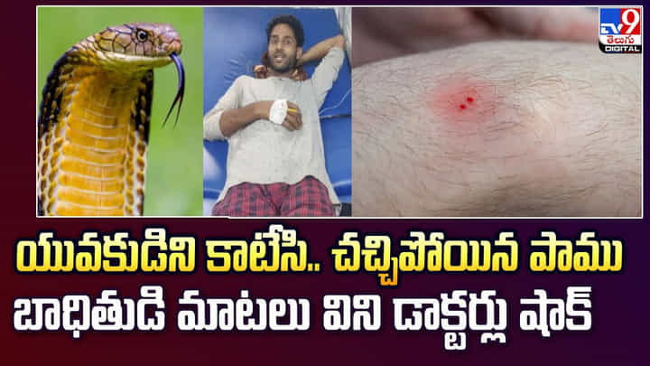 యువకుడిని కాటేసి.. చచ్చిపోయిన పాము.. బాధితుడి మాటలు విని డాక్టర్లు షాక్ యువకుడిని కాటేసి.. చచ్చిపోయిన పాము.. బాధితుడి మాటలు విని డాక్టర్లు షాక్