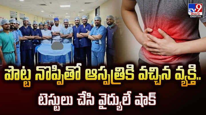 పొట్ట నొప్పితో ఆస్పత్రికి వచ్చిన వ్యక్తి.. టెస్టులు చేసి వైద్యులే షాక్ పొట్ట నొప్పితో ఆస్పత్రికి వచ్చిన వ్యక్తి.. టెస్టులు చేసి వైద్యులే షాక్