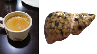 Coffee: మహిళల దీర్ఘాయుష్షుకు కారణం కనిపెట్టిన సైంటిస్టులు.. కాఫీ కప్పులోనే ఉంది రహస్యం