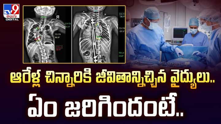 ఆరేళ్ల చిన్నారికి జీవితాన్నిచ్చిన వైద్యులు..ఏం జరిగిందంటే వీడియో ఆరేళ్ల చిన్నారికి జీవితాన్నిచ్చిన వైద్యులు..ఏం జరిగిందంటే వీడియో