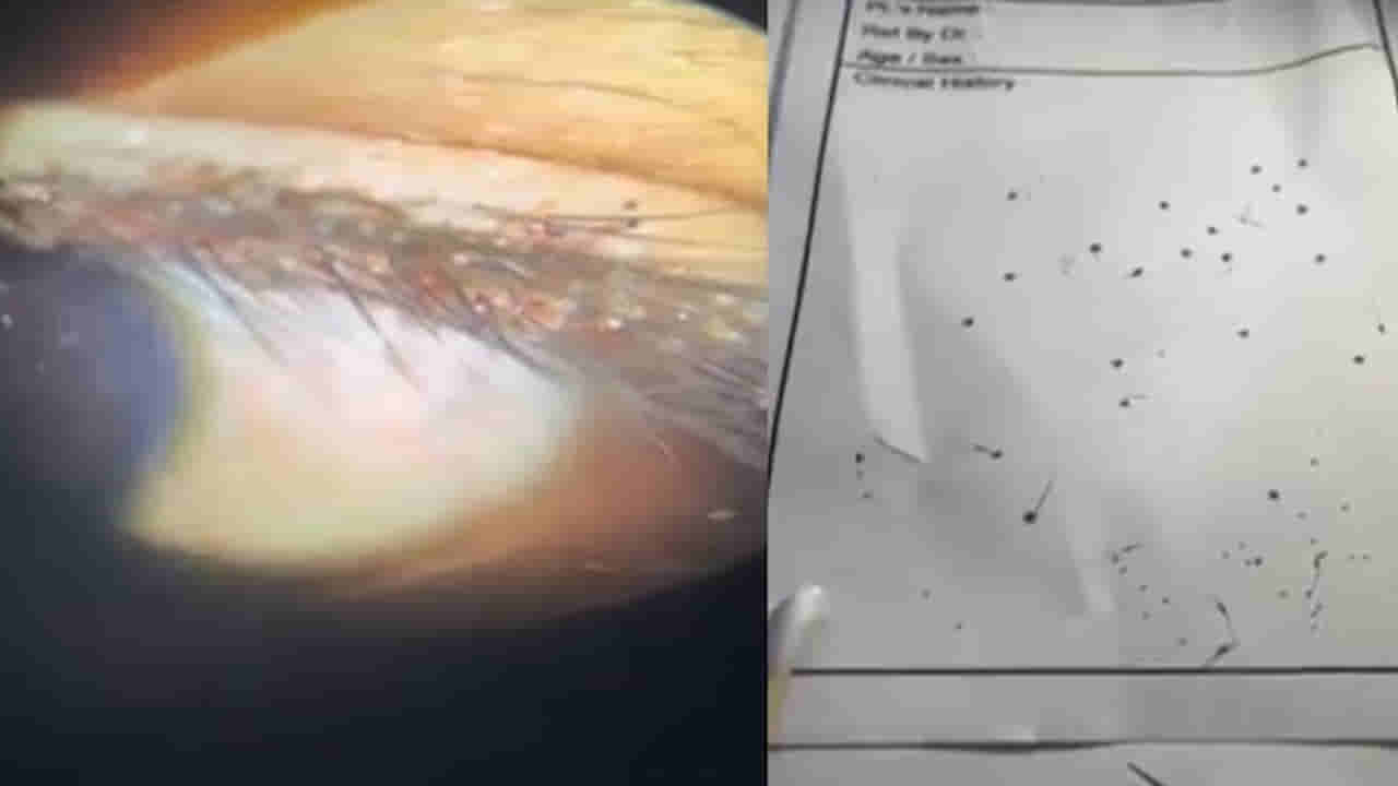 Viral News: 8 ఏళ్ల బాలుడికి ఎంతకూ తగ్గని కంటి నొప్పి.. పరుగున ఆస్పత్రికి తీసుకెళ్లగా..