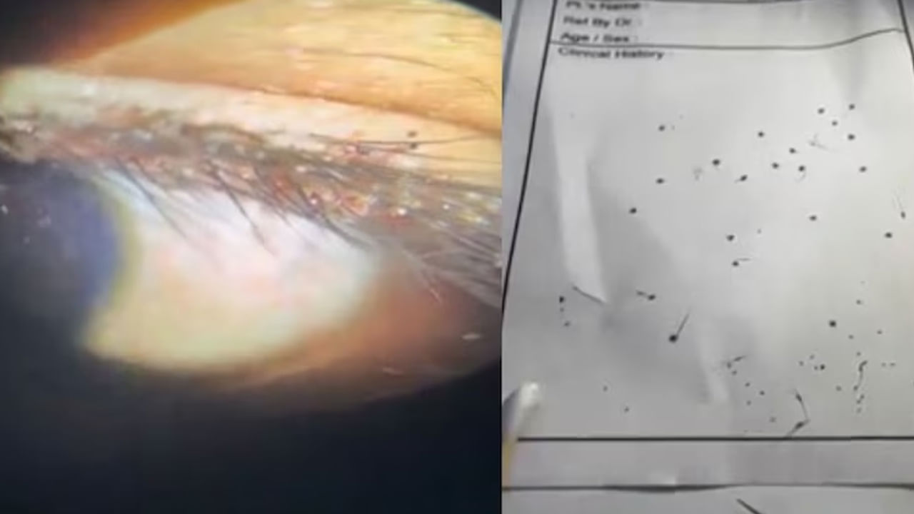 Viral News: 8 ఏళ్ల బాలుడికి ఎంతకూ తగ్గని కంటి నొప్పి.. పరుగున ఆస్పత్రికి తీసుకెళ్లగా..