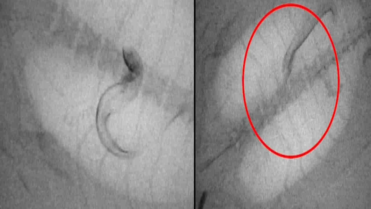 Viral Video: అనుమానమొచ్చి చేప కడుపు ఎక్స్‌రే తీశారు.. లోపల కనిపించింది చూడగా