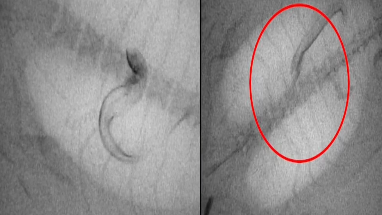 Viral Video: అనుమానమొచ్చి చేప కడుపు ఎక్స్‌రే తీశారు.. లోపల కనిపించింది చూడగా