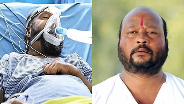 Fish Venkat: ఫిష్ వెంకట్ బతకాలంటే అదొక్కటే మార్గం.. నటుడి ఆరోగ్య పరిస్థితిపై డాక్టర్ కీలక ప్రకటన