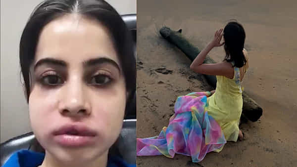 బెడిసికొట్టిన సర్జరీ.. గుర్తుపట్టలేనంతగా మారిన నటి.. తిట్టిపోస్తున్న నెటిజన్స్