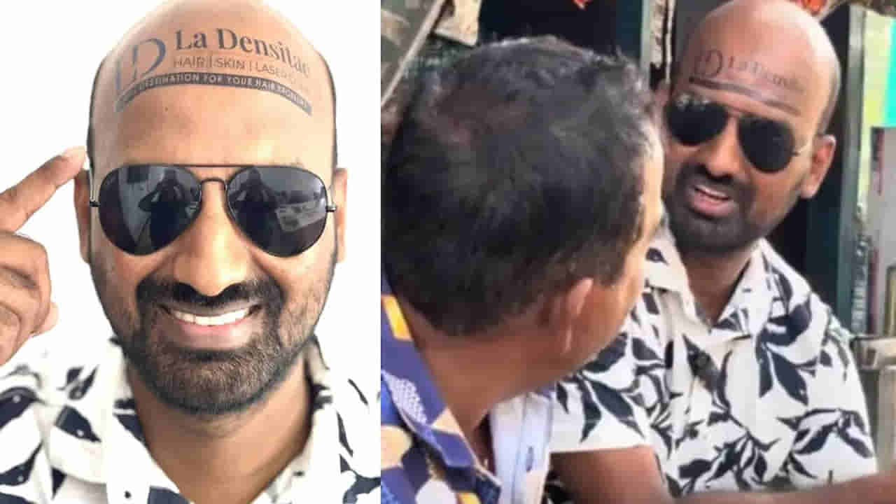 Viral News: బట్టతలనే బిల్బోర్డ్ గా మార్చుకున్న యువకుడు.. వేలల్లో సంపాదన