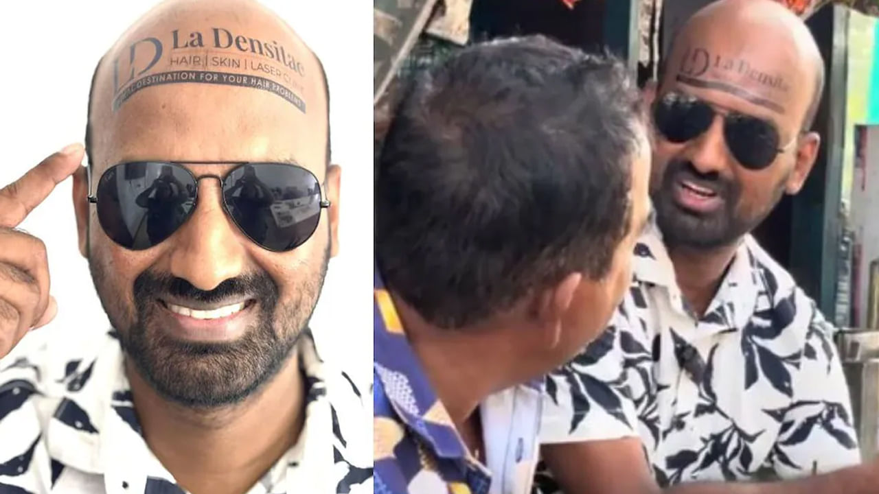 Viral News: బట్టతలనే బిల్బోర్డ్ గా మార్చుకున్న యువకుడు.. వేలల్లో సంపాదన