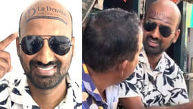 బట్టతలసమస్యా ఆందోళన వద్దు బిల్బోర్డ్ చేసుకుని డబ్బులుసంపాదించండి బట్టతలసమస్యా ఆందోళన వద్దు బిల్బోర్డ్ చేసుకుని డబ్బులుసంపాదించండి