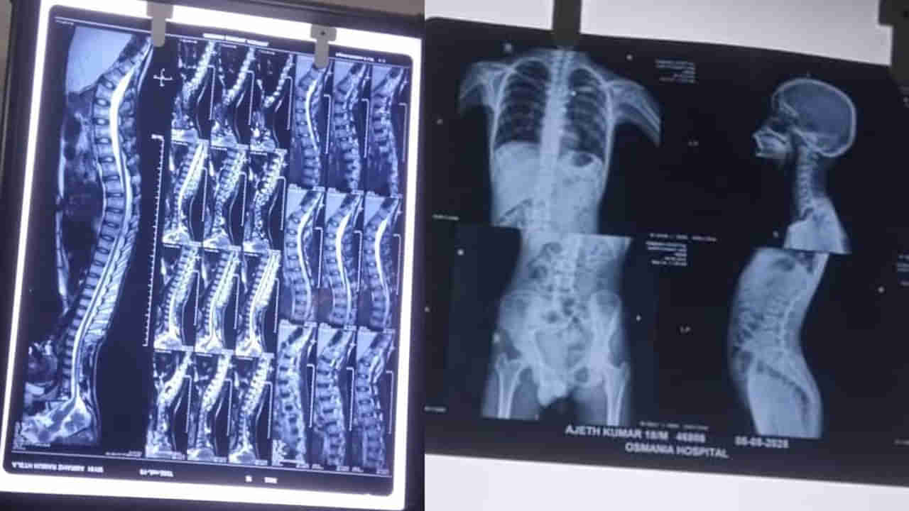 Yousufguda: పక్కింటి వ్యక్తిని వీడియో తీశాడని పోలీస్ స్టేషన్‌కు తీసుకెళ్లారు - ఆ తర్వాత ఇది సిట్యువేషన్