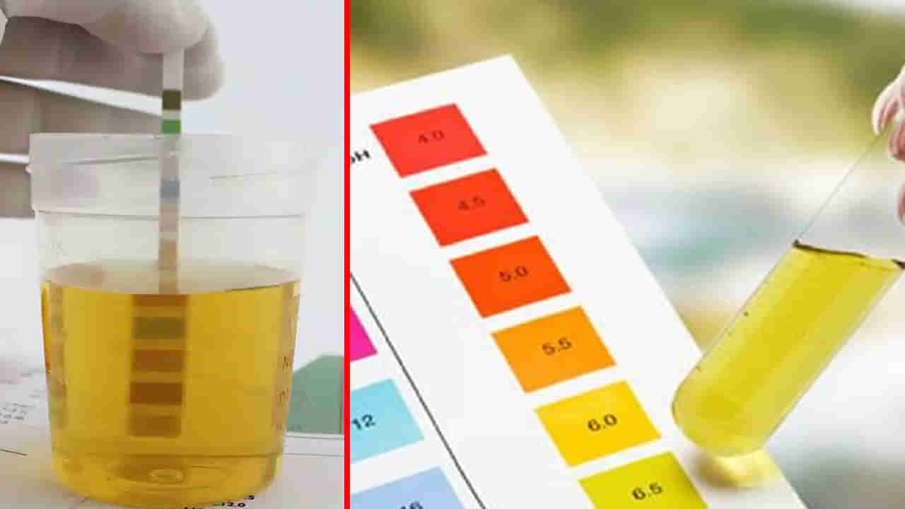మూత్రం పసుపు రంగులో వస్తుందా..? ఆ ప్రమాదకర వ్యాధులకు సంకేతం కావొచ్చు..