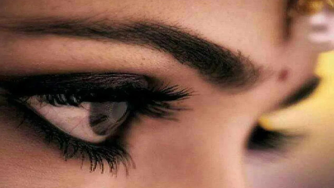 Eye 3