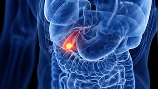 Driving Back Pain: డ్రైవింగ్‌ సమయంలో వెన్నునొప్పి.. ఈ టిప్స్ చాలు.. ప్రయాణం సాఫీగా..