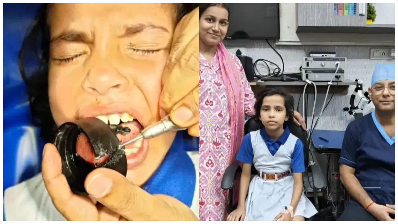 నీళ్లు తాగుతుండగా బాటిల్ మూతలో ఇరుక్కుపోయిన బాలిక నాలుక.. చివరకు ఏమైందంటే..