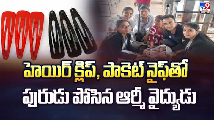 హెయిర్ క్లిప్, పాకెట్ నైఫ్తో పురుడు పోసిన ఆర్మీ వైద్యుడు వీడియో హెయిర్ క్లిప్, పాకెట్ నైఫ్తో పురుడు పోసిన ఆర్మీ వైద్యుడు వీడియో