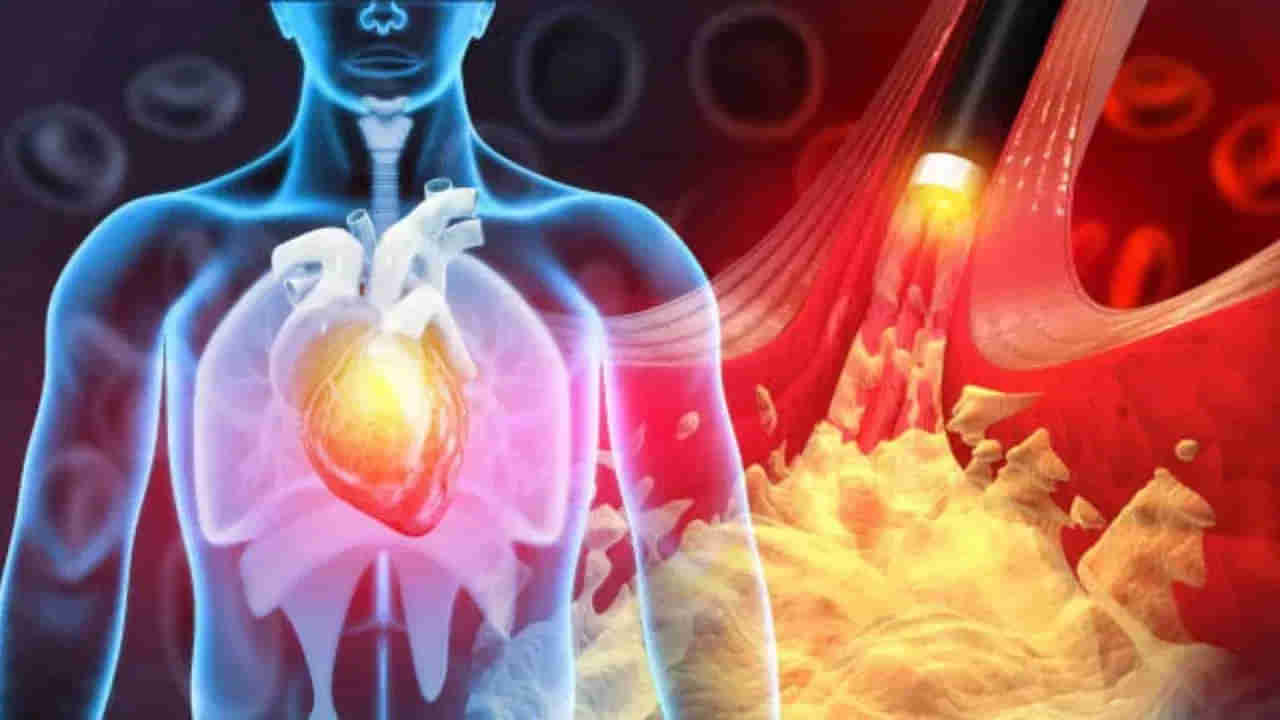 Heart Attack: గుండెపోటు వచ్చే 30 నిమిషాల ముందు కనిపించే లక్షణాలు ఇవేనట..!