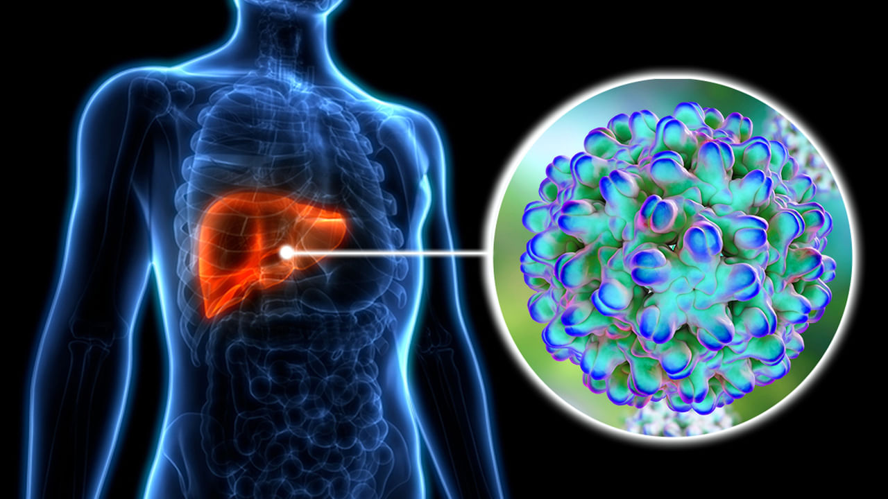 Hepatitis: ఈ వ్యాధి సైలెంట్‌ కిల్లర్‌..! లక్షణాలు కనిపించకుండానే ప్రాణాలను మింగేస్తుంది..