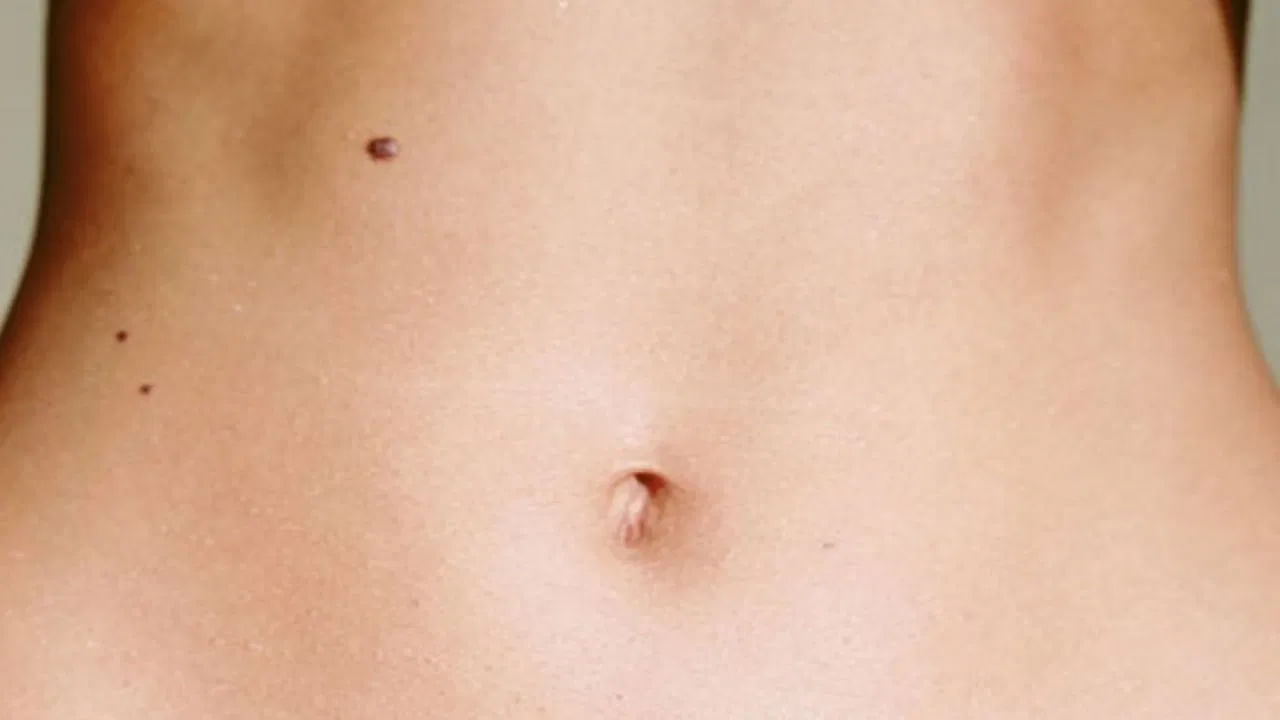 ఈ పుట్టుమచ్చ ఒక వ్యక్తి వ్యక్తిత్వం గురించి, అతని స్వభావం ఎలా ఉంటుందో కూడా చెబుతుందని నమ్ముతారు. అటువంటి పరిస్థితిలో ఈ రోజు మనం శరీరంలో పుట్టుమచ్చ ఉన్న భాగం గురించి తెలుసుకుందాం. అంటే కడుపు మీద(పొట్టపై) పుట్టుమచ్చ ఉన్న వ్యక్తి లక్షణాల గురించి తెలుసుకుందాం. ఆ వ్యక్తి చాలా అదృష్టవంతుడిగా పరిగణించబడతాడు. అతను తినడానికి, త్రాగడానికి ఇష్టపడతాడని కూడా అంటారు.
