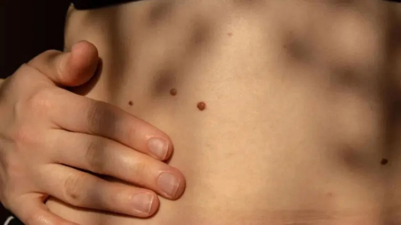 సాముద్రిక శాస్త్రం ప్రకారం కడుపుపై ​​పుట్టుమచ్చ ఉన్న స్త్రీలు, పురుషులపై వేర్వేరు ప్రభావాలను చూపుతుంది. పురుషుల కడుపుపై ​​పుట్టుమచ్చ ఉండటం అంటే వారు కెరీర్ రంగంలో ముందుంటారని, వారికి డబ్బుకు  కొరత ఉండదని చెబుతారు. 