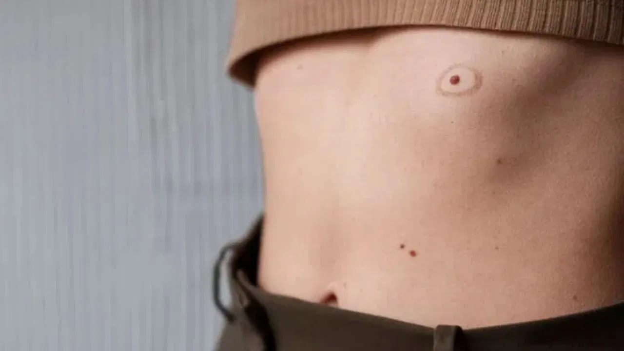 పొట్టపై కుడి వైపున పుట్టుమచ్చ ఉంటే అలాంటి వ్యక్తులు చాలా అదృష్టవంతులు. వీరికి ఎల్లప్పుడూ తమ లక్ష్యం గురించి స్పష్టమైన దృష్టి ఉంటుంది. దీనిని సాధించిన తర్వాతే వీరు సంతృప్తి చెందుతారు. అలాంటి వ్యక్తులు కెరీర్‌తో సహా ప్రతి రంగంలోనూ విజయం సాధిస్తారు. అంతేకాదు వీరి జీవితంలో ఎప్పుడూ డబ్బు కొరత ఉండదు. వీరి  జీవితంలో ప్రేమ చాలా సంతోషంగా ఉంటుంది. వీరి వ్యక్తిత్వం ప్రజలపై చాలా ప్రభావం చూపుతుంది.