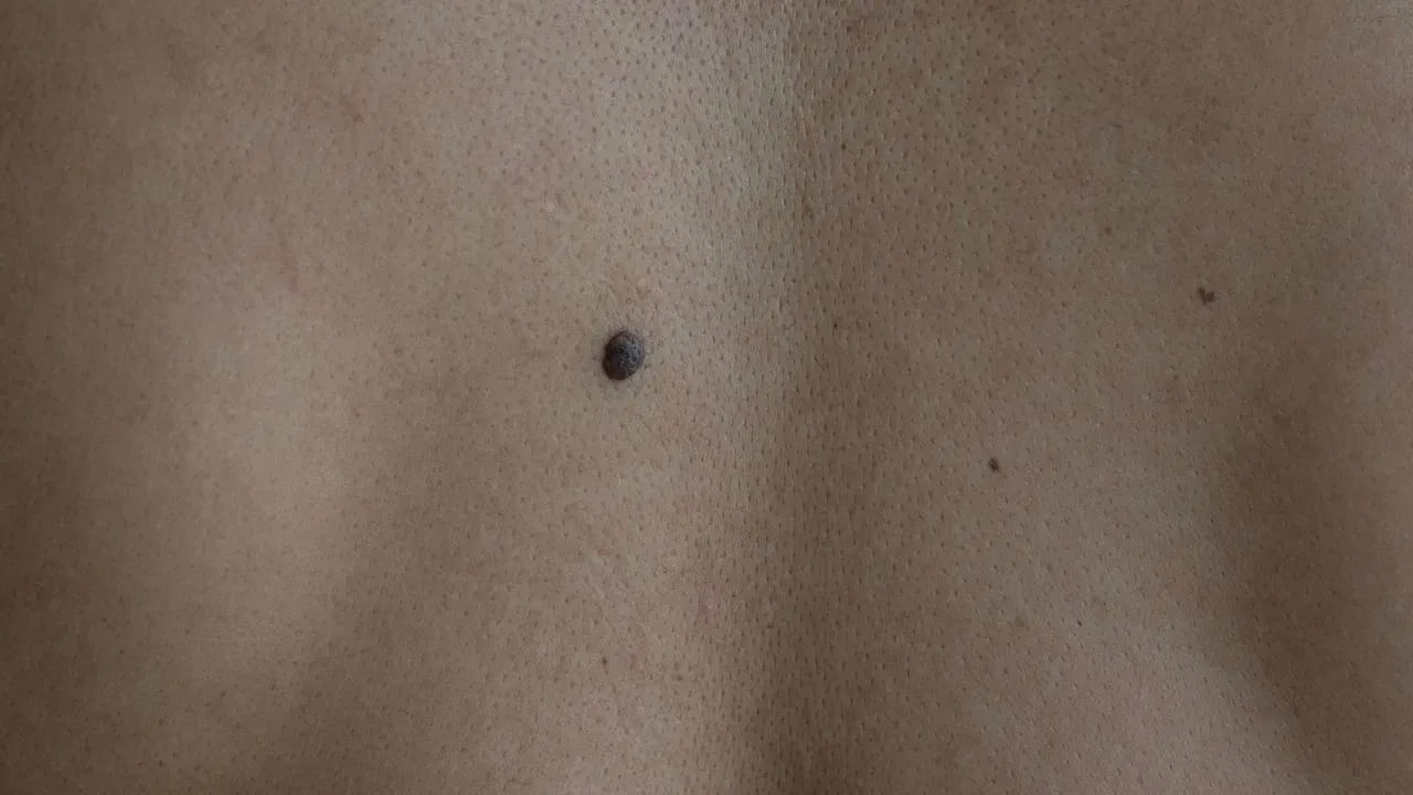 పొట్టపై ఎడమ వైపున పుట్టుమచ్చ ఉంటే.. అటువంటి వ్యక్తుల జీవితం చాలా సవాలుతో కూడుకున్నది. అతను తన లక్ష్యాలను సాధించడానికి చాలా కష్టపడాలి. అప్పుడే అదృష్టం అతనికి అనుకూలంగా ఉంటుంది. అంతేకాదు ఇలా పుట్టుమచ్చ ఉన్న వ్యక్తులు ఎక్కువగా మాట్లాడతారు. అంతేకాదు ఆస్థిపరులు.  
