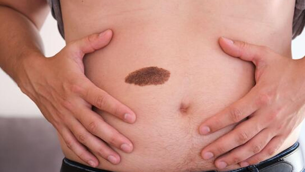 పొట్టమీద పుట్టుమచ్చ ఉందని చెప్పడానికి మరో సంకేతం ఏమిటంటే.. ఇలా పుట్టుమచ్చ ఉన్న వ్యక్తుల జీర్ణవ్యవస్థ చాలా బలహీనంగా ఉంటుంది. కనుక వీరు ఎప్పుడూ ఈ విషయంపై జాగ్రత్తగా ఉండాలి. దీనితో పాటు ఇలా పుట్టుమచ్చలు ఉన్నవారికీ తినడం అంటే మహా ఇష్టం. వీరు తినాలనే కోరికను అసలు నియంత్రించుకోలేరట. (ఈ వార్తలలో ఇవ్వబడిన సమాచారం మత విశ్వాసాలపై ఆధారపడి ఉంది. పాఠకుల ఆసక్తి మేరకు.. పలువురు పండితుల సూచనలు, వారి తెలిపిన అంశాల ఆధారంగా అందించినవి మాత్రమే.. వీటిలో ఎలాంటి శాస్త్రీయ ఆధారాలు లేవని పాఠకులు గమనించాలి. టీవీ9 తెలుగు దీనిని ధృవీకరించలేదు.)