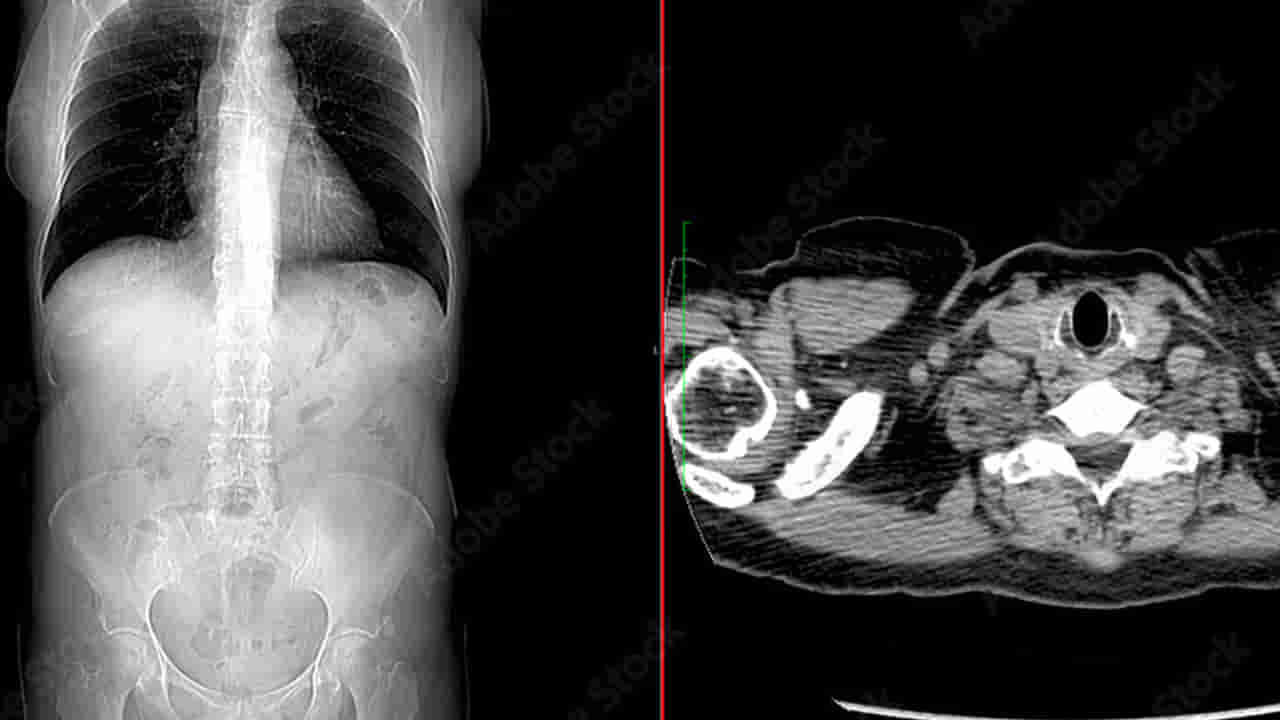 Viral: ఆకలి అవ్వడం లేదంటూ ఆస్పత్రికి వచ్చిన యువతి - స్కాన్ తీసి అవాక్కయిన వైద్యులు