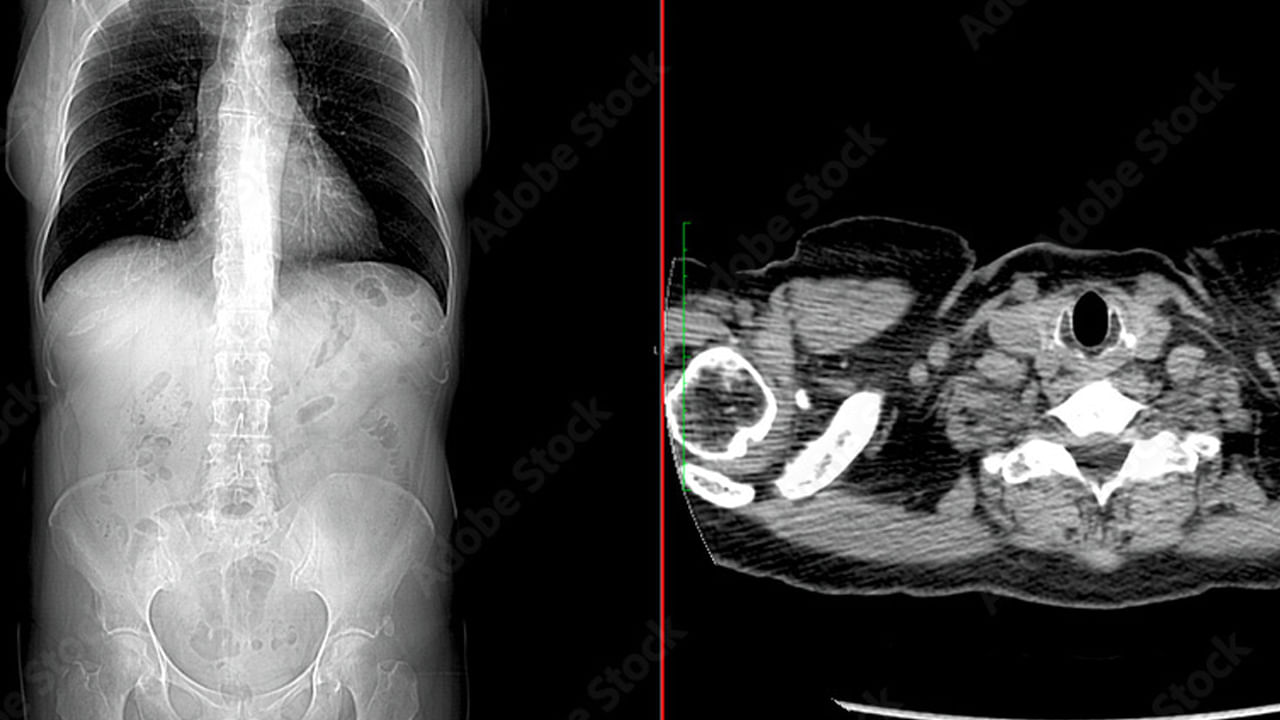 Viral: ఆకలి అవ్వడం లేదంటూ ఆస్పత్రికి వచ్చిన యువతి - స్కాన్ తీసి అవాక్కయిన వైద్యులు