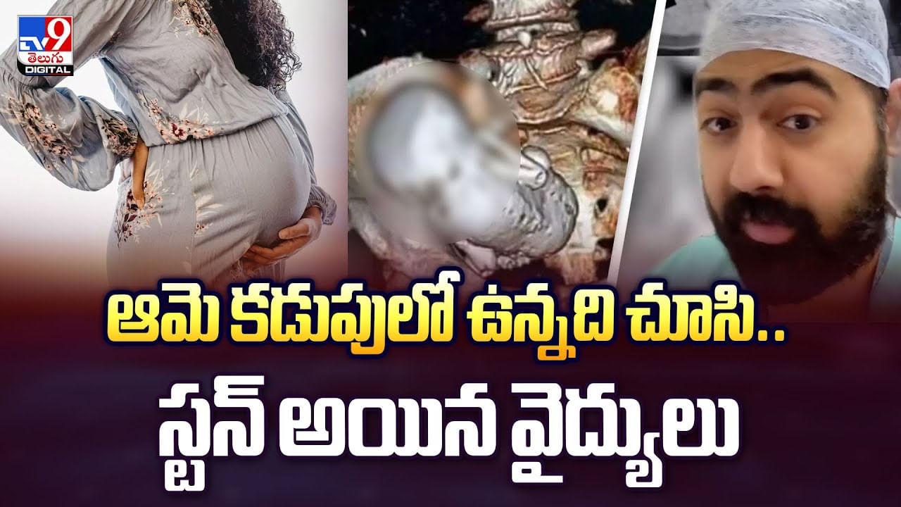 ఆమె కడుపులో ఉన్నది చూసి .. స్టన్ అయిన వైద్యులు వీడియో