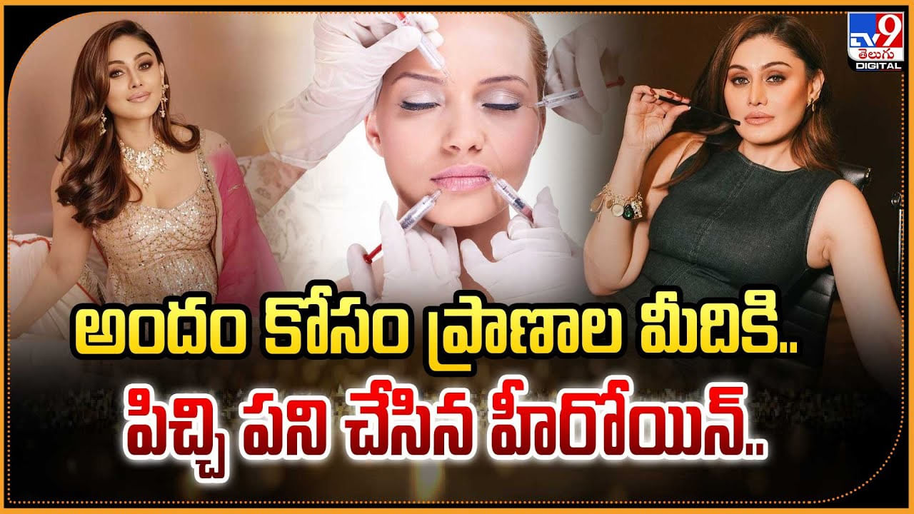 అందం కోసం ప్రాణాల మీదికి.. పిచ్చి పని చేసిన హీరోయిన్..