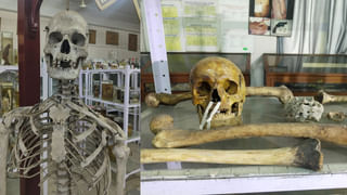 ఎముకలు, అస్థిపజరం ఆధారంగా చనిపోయిన వారి వివరాలు ఎలా గుర్తిస్తారో తెలుసా..