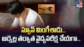 Viral: వ్యక్తికి ఆగకుండా రక్తపు వాంతులు, వికారం.. టెస్టులు చేయగా.. ‌ఎక్స్‌రేలో