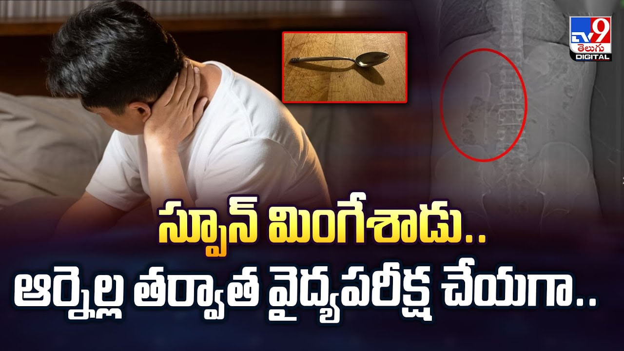 స్పూన్‌ మింగేశాడు..ఆర్నెల్ల తర్వాత వైద్యపరీక్ష చేయగా వీడియో