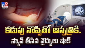 కడుపు నొప్పితో ఆస్పత్రికి.. స్కాన్ తీసిన వైద్యులు షాక్ కడుపు నొప్పితో ఆస్పత్రికి.. స్కాన్ తీసిన వైద్యులు షాక్