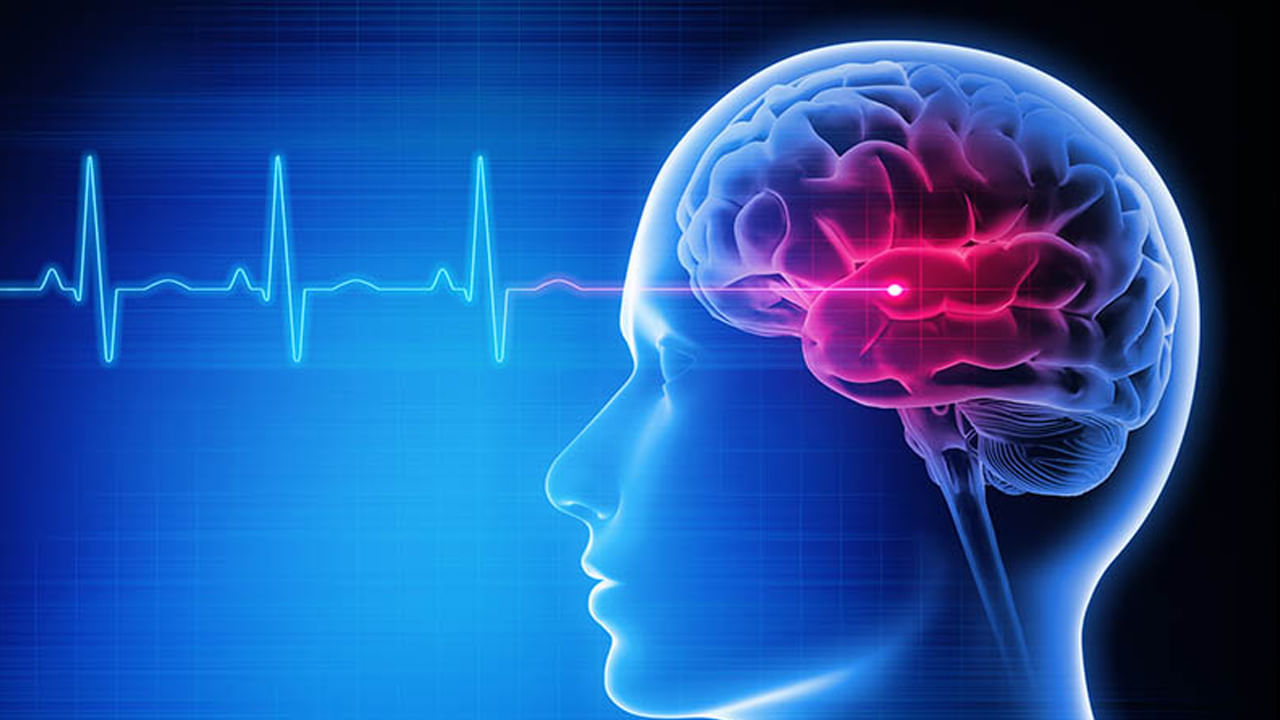 అస్పష్టమైన దృష్టి : స్ట్రోక్ రావడానికి ఒక నెల ముందు దృష్టిలో మార్పులు వస్తాయంట. అస్పష్టంగా కనిపించడం వంటి సమస్యలు వచ్చినట్లైతే ఇది స్ట్రోక్ ముందస్తు హెచ్చరిక అంటున్నారు ఆరోగ్య నిపుణులు. అందుకే ఈ సమస్య ఉంటే నిర్లక్ష్యం చేయకూడదని చెబుతున్నారు వైద్యులు.