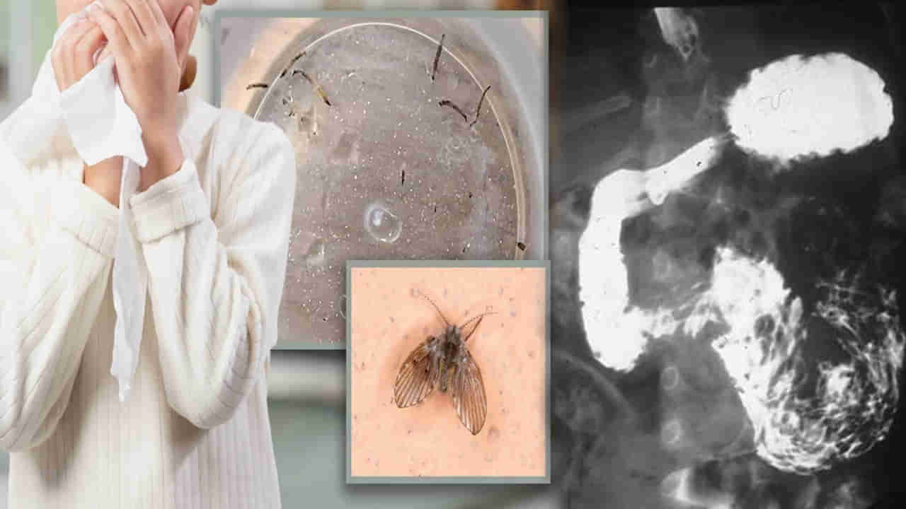 Viral: చిన్నారికి ఆగకుండా వాంతులు.. ఆస్పత్రికి తీసుకెళ్లగా.. ఎక్స్‌రేలో సెంటీమీటర్ పొడవైన..