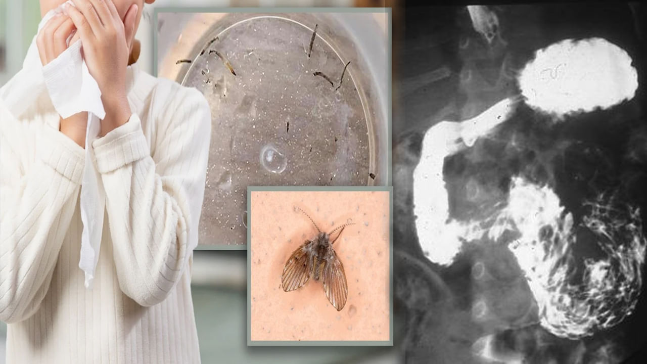 Viral: చిన్నారికి ఆగకుండా వాంతులు.. ఆస్పత్రికి తీసుకెళ్లగా.. ఎక్స్‌రేలో సెంటీమీటర్ పొడవైన..