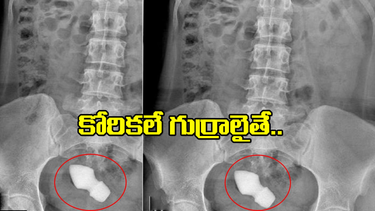 Viral: కంత్రీ కోరికలు.. కరువెక్కిపోయి కడుపునొప్పితో ఆస్పత్రికి.. ఆపై టెస్టులు చేయగా