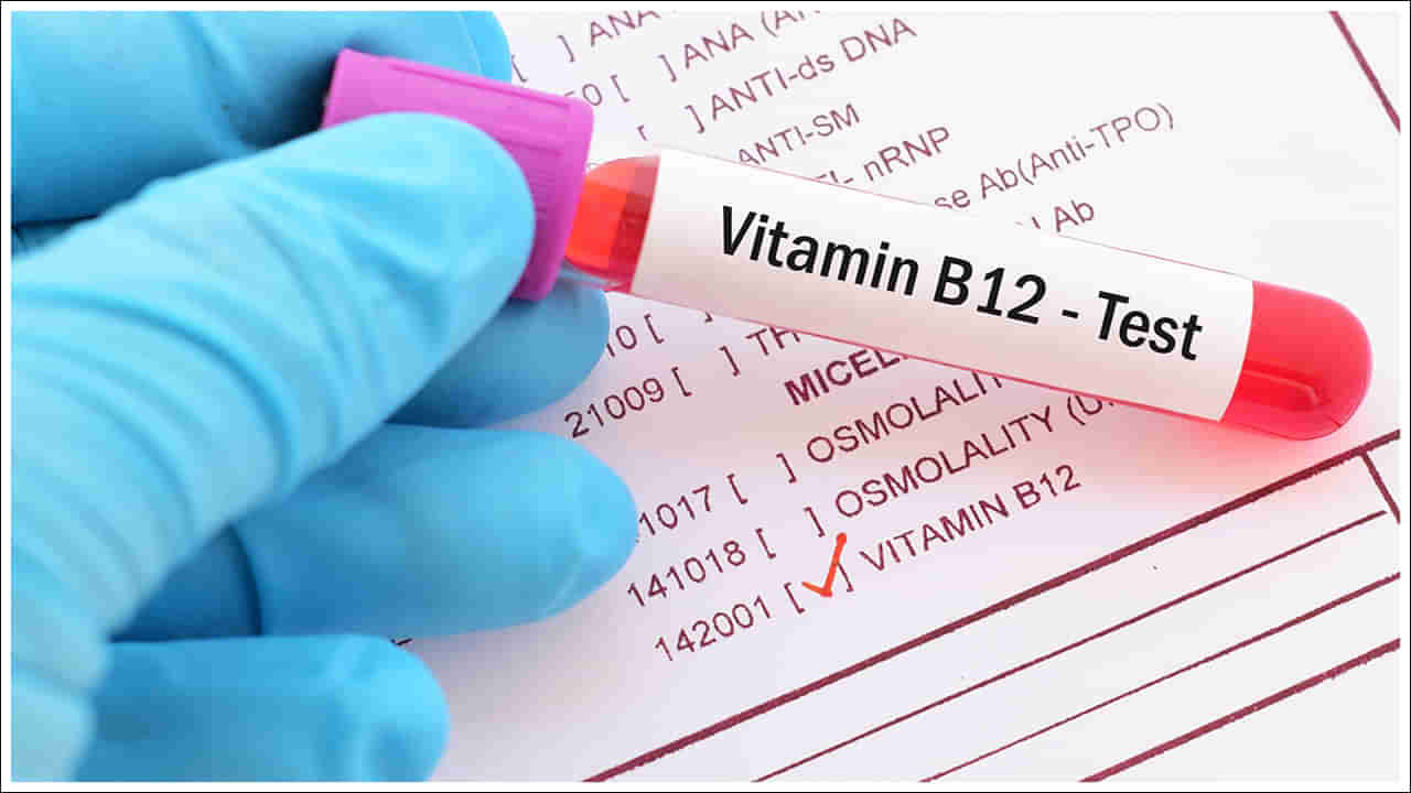 Vitamin B12: విటమిన్ బి12 లోపం మరణానికి దారితీస్తుందా? అది శరీరానికి ఎంత హాని కలిగిస్తుందో తెలుసా?