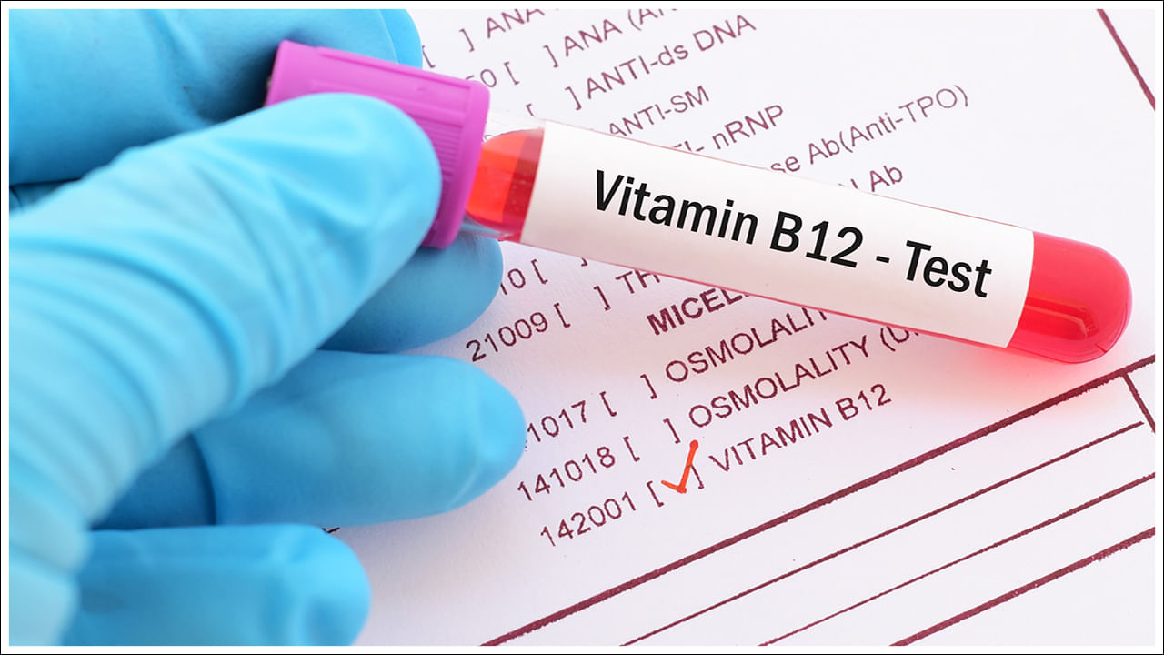 Vitamin B12: విటమిన్ బి12 లోపం మరణానికి దారితీస్తుందా? అది శరీరానికి ఎంత హాని కలిగిస్తుందో తెలుసా?