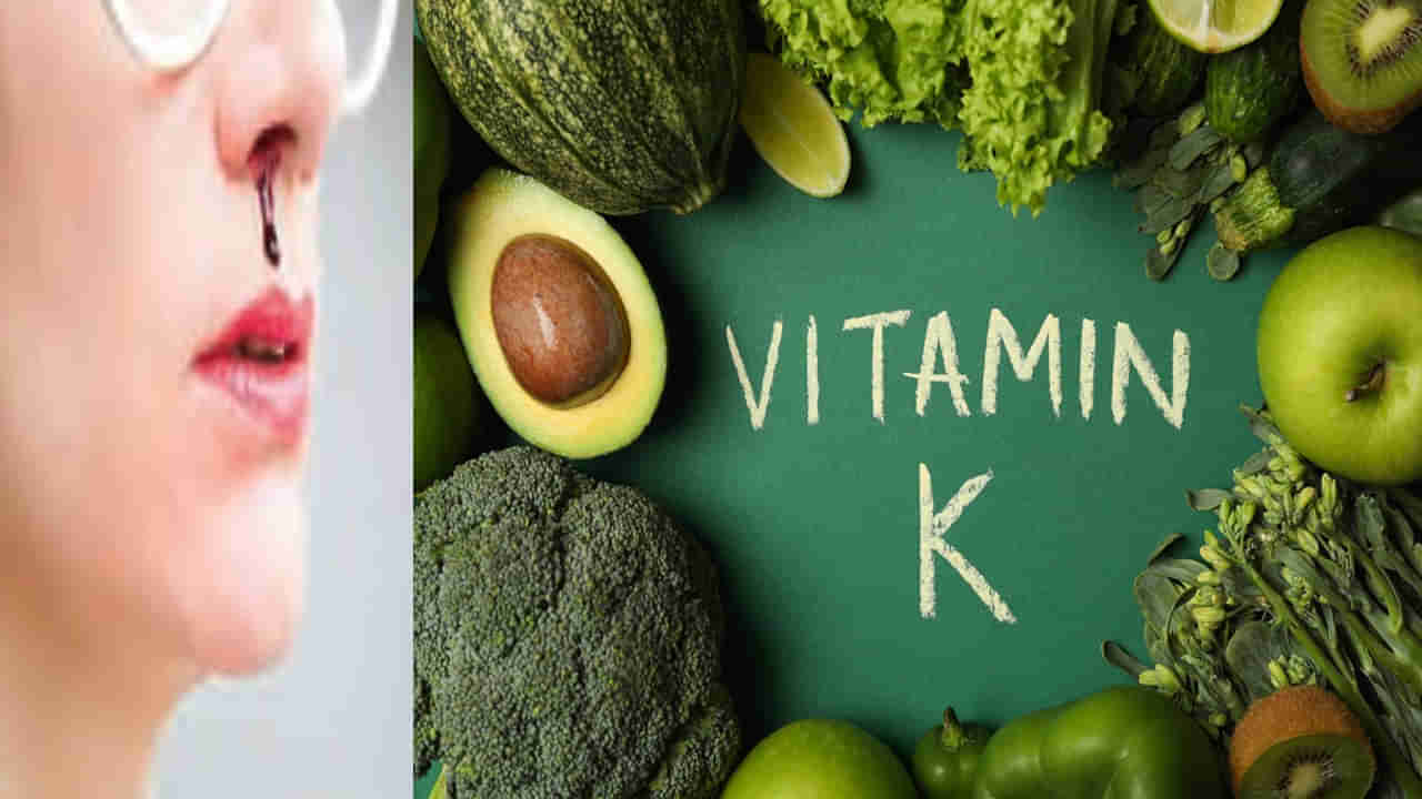 Vitamin K: ఈ లక్షణాలు కనిపిస్తే ప్రమాదకరం.. విటమిన్ కె లోపం ఏమో చెక్ చేసుకోండి.. తినే ఆహారంలో వీటిని చేర్చుకోండి..