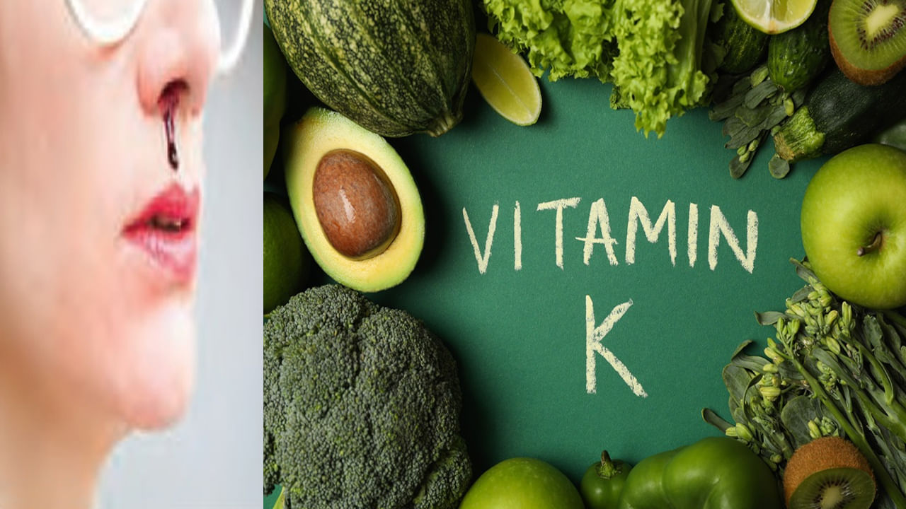 Vitamin K: ఈ లక్షణాలు కనిపిస్తే ప్రమాదకరం.. విటమిన్ కె లోపం ఏమో చెక్ చేసుకోండి.. తినే ఆహారంలో వీటిని చేర్చుకోండి..