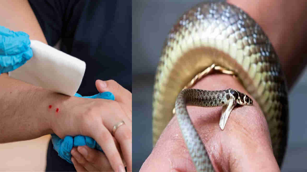 World Snake Day: పాము కరిస్తే ఇలా చేయండి.. ప్రాణాలు కాపాడండి.. ప్రాధమిక చికిత్సే అమూల్యం..