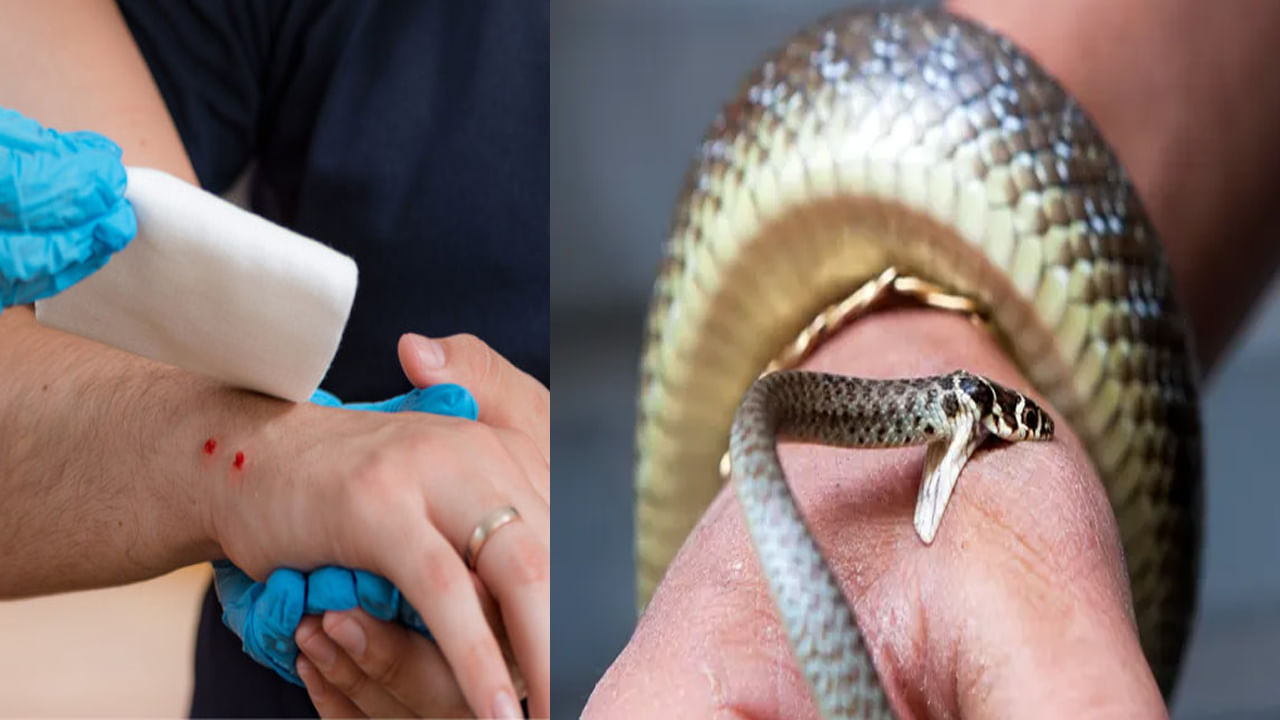 World Snake Day: పాము కరిస్తే ఇలా చేయండి.. ప్రాణాలు కాపాడండి.. ప్రాధమిక చికిత్సే అమూల్యం..